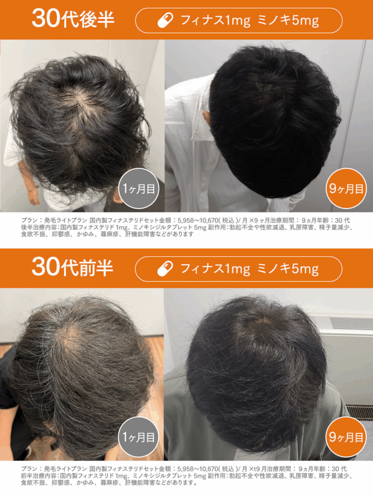 Before /After