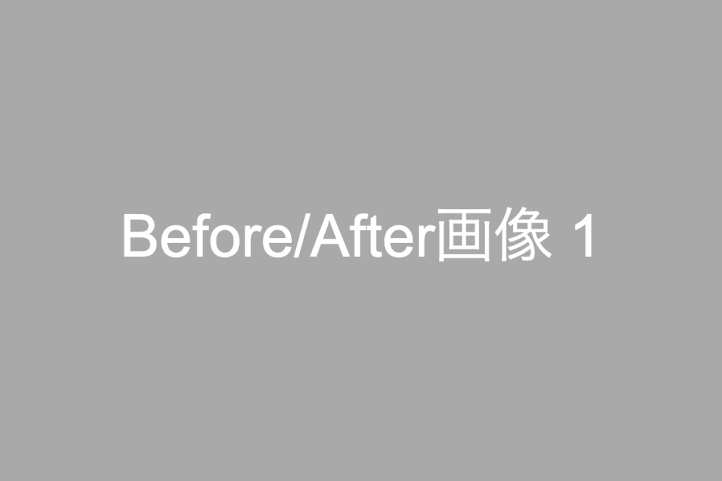 Before /After
